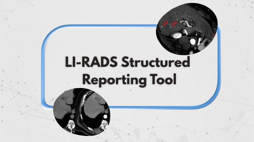 LI-RADS Structured Reporting Tool